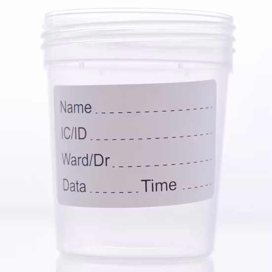 Muestra desechable de 60 ml de recipiente de orina roja para hospital